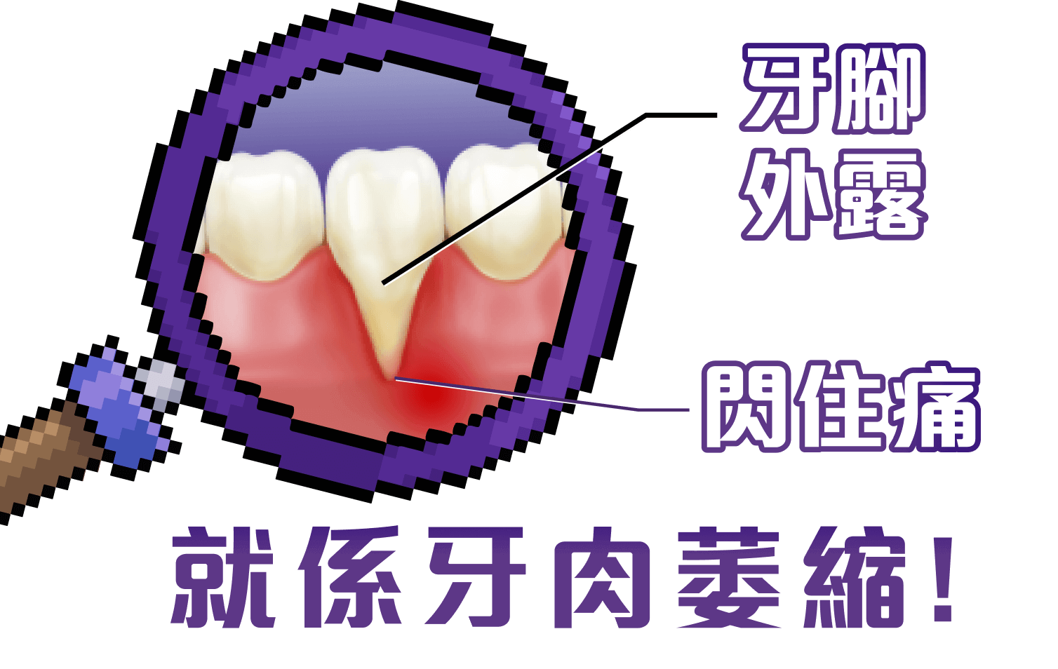 牙肉外露閃住痛就係牙肉萎縮