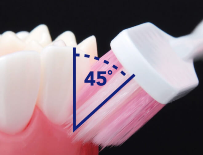 凸級緊貼刷淨牙齦溝間